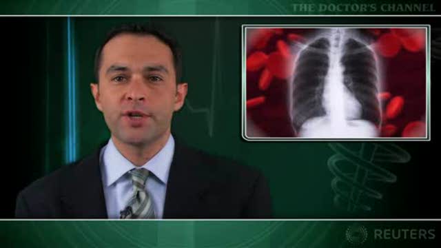 Lung volume reduction surgery decreases need for oxygen therapy in COPD Thumbnail