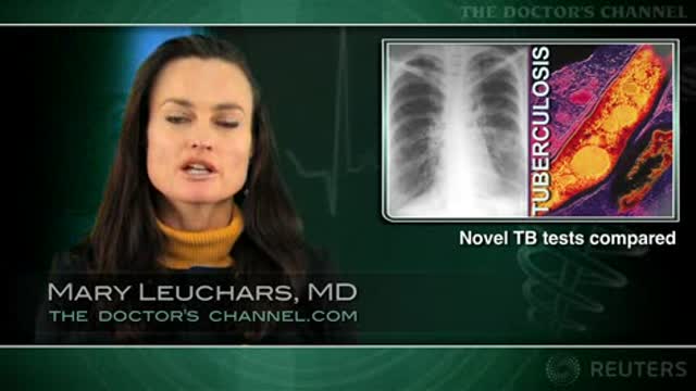 Interferon assays better than skin test for detecting active TB Thumbnail