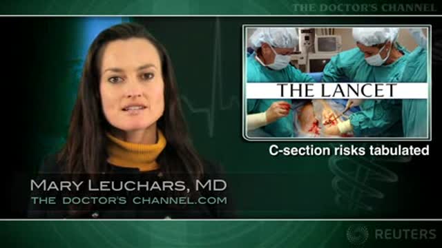C-sections, necessary or not, increase maternal morbidity and mortality Thumbnail