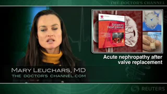 Transcatheter aortic valve implantation leaves 1 in 10 patients with kidney injury Thumbnail