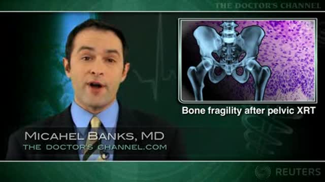 Radiotherapy for cervical cancer increases pelvic fracture risk Thumbnail