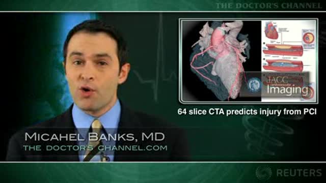Coronary plaque characteristics on CT angiography predict post-catheterization injury Thumbnail