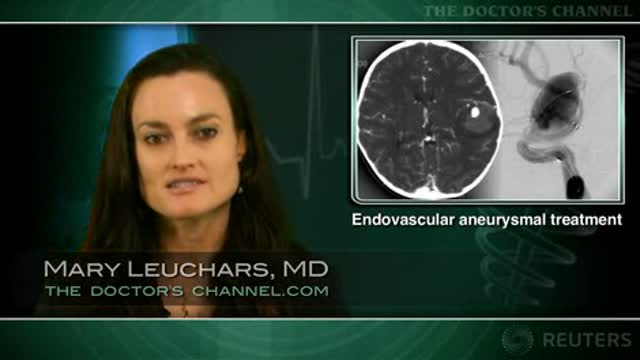 Endovascular treatment usually effective for very small brain aneurysms Thumbnail