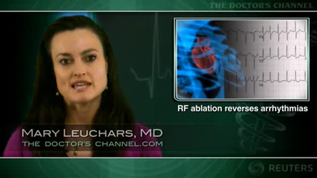 Catheter ablation beats drug therapy for refractory atrial fibrillation Thumbnail