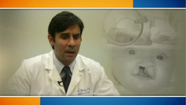 Cleft lip and palate Thumbnail