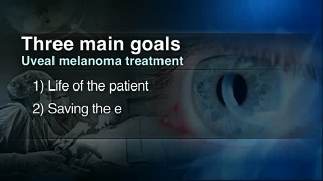 Uveual melanoma treatment Thumbnail
