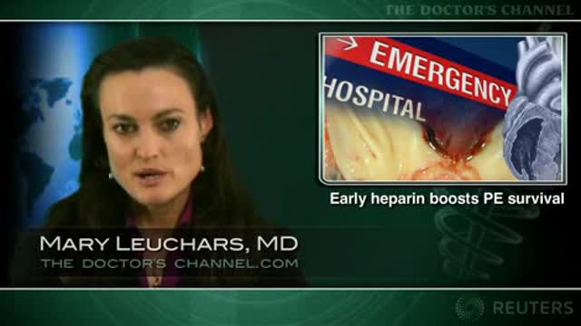 Early anticoagulation may improve survival after pulmonary embolism Thumbnail