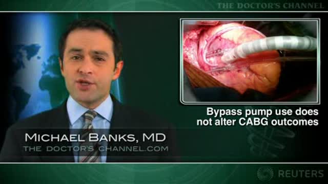 Short-term outcomes same for CABG with and without bypass Thumbnail