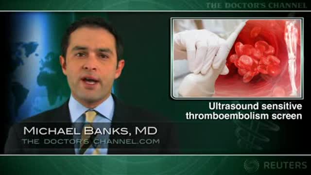 Single ultrasound test may suffice to rule out DVT Thumbnail
