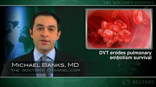 DVT predicts death in patients with pulmonary embolism Thumbnail