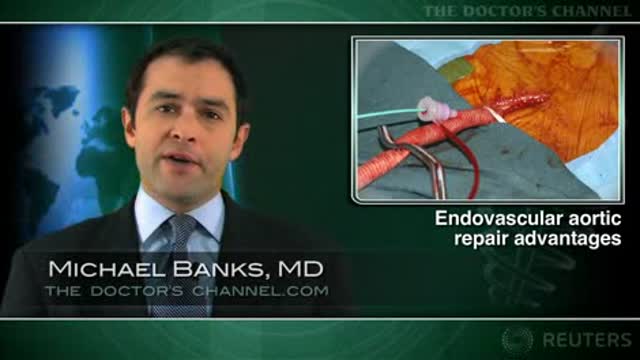 Endovascular aortic repair offers many short-term benefits over open surgery Thumbnail