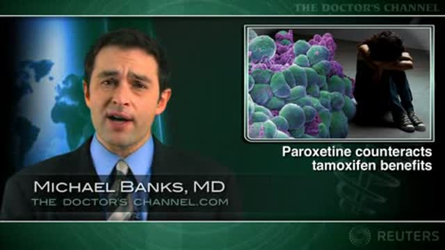 Paroxetine limits the benefit of tamoxifen for breast cancer survival Thumbnail