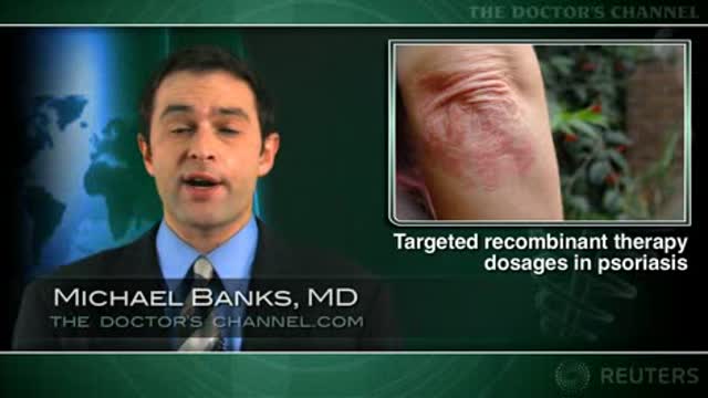 Skin manifestations of psoriatic arthritis respond best to twice weekly etanercept Thumbnail