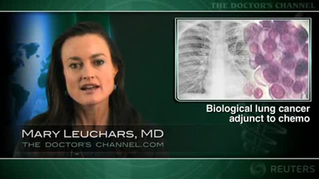 Adding cetuximab may improve treatment of lung cancer Thumbnail