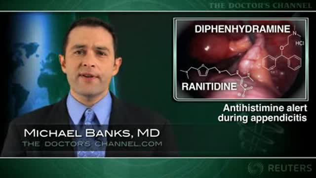 Avoid diphenhydramine, ranitidine after perforated appendicitis: study Thumbnail