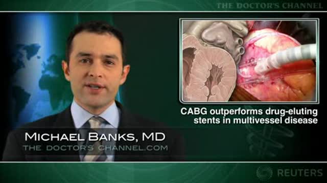 CABG more durable than PCI with sirolimus-eluting stents for multivessel disease Thumbnail