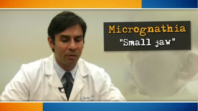 Micrognathia and neonatal mandibular distraction Thumbnail
