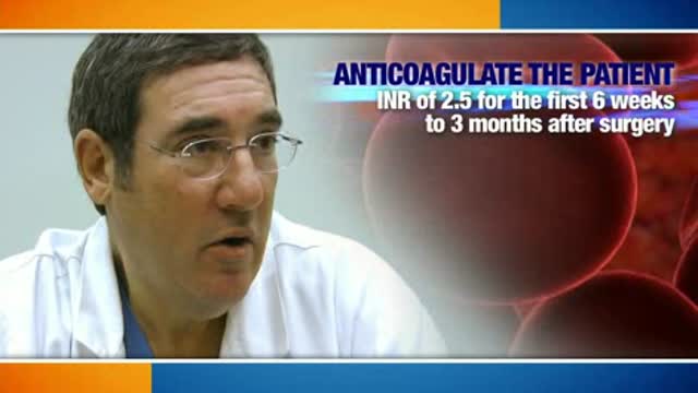 Anticoagulation and Maze procedure after mitral valve repair Thumbnail