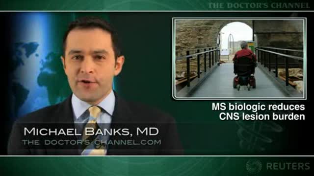 Add-on daclizumab reduces disease activity in multiple sclerosis Thumbnail