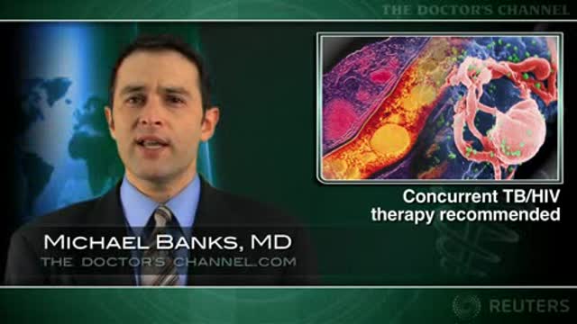 Treatments for HIV/TB co-infection should start at the same time: study Thumbnail