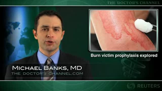 Prophylactic antibiotics may cut mortality in burn patients Thumbnail