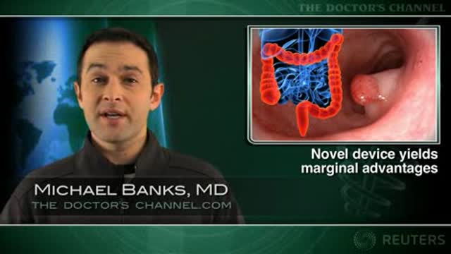 Chromocolonoscopy not helpful for routine colon cancer screening Thumbnail