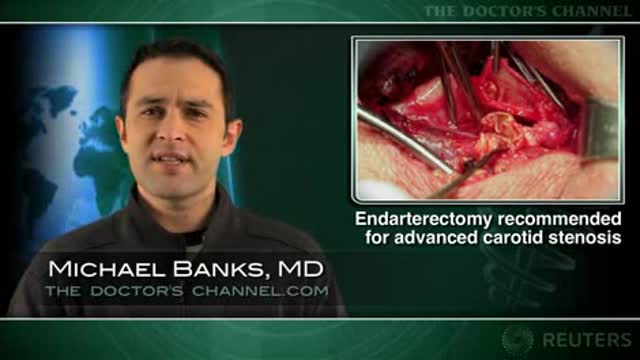 Surgery favored over stenting for symptomatic carotid stenosis Thumbnail