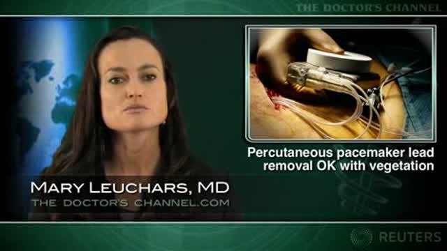 Cardiac vegetations don’t rule out percutaneous ICD lead extraction Thumbnail