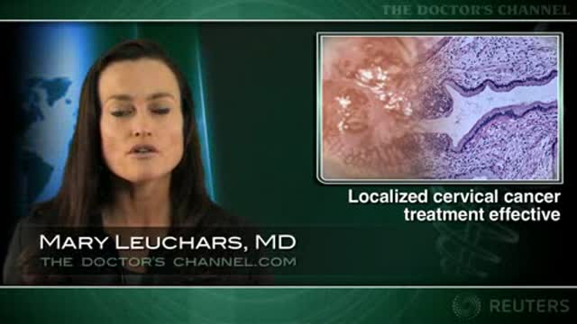 Fertility-conserving surgery safe for early cervical cancer Thumbnail