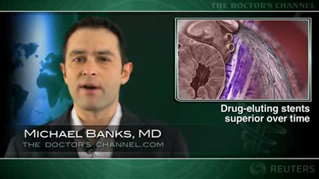 Longer follow-up confirms advantage of sirolimus-eluting vs bare metal stents Thumbnail