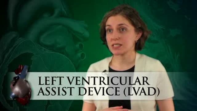 LVADs in Heart Failure Therapy Thumbnail