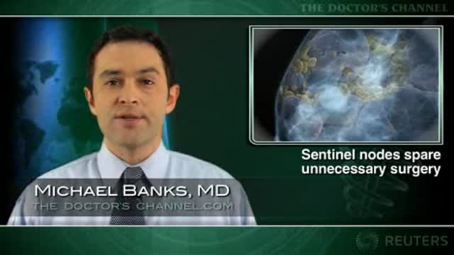 Long-term breast cancer survival similar with SNLB and complete axillary dissection Thumbnail