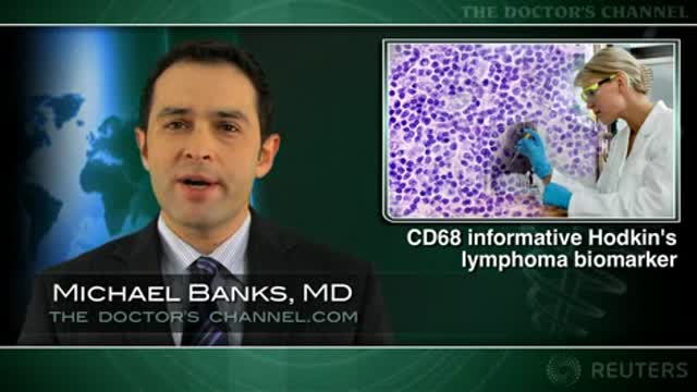 CD68+ macrophages linked to treatment failure in Hodgkin’s lymphoma Thumbnail