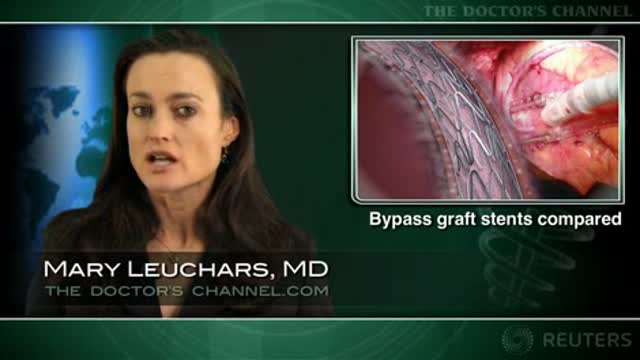 Drug-eluting stents better than bare metal for saphenous vein graft interventions Thumbnail