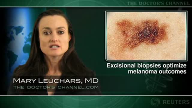 Excisional biopsy best for diagnosing melanoma Thumbnail