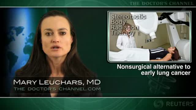 Stereotactic radiation controls early stage lung cancer Thumbnail