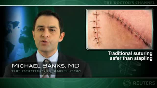Staple skin closure ups infection risk with orthopedic surgery Thumbnail