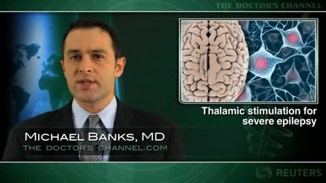 Deep brain stimulation reduces epileptic seizures Thumbnail