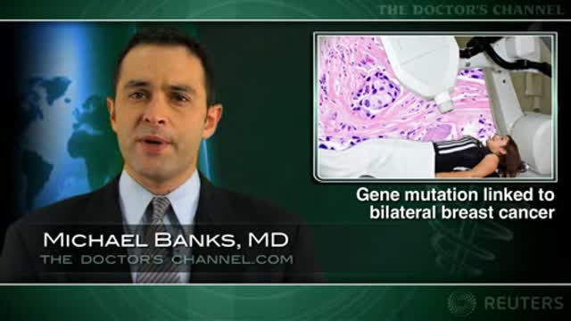 Gene variants plus radiotherapy may up risk of contralateral breast cancer Thumbnail