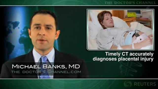 CT pinpoints placental injury from pregnancy trauma Thumbnail