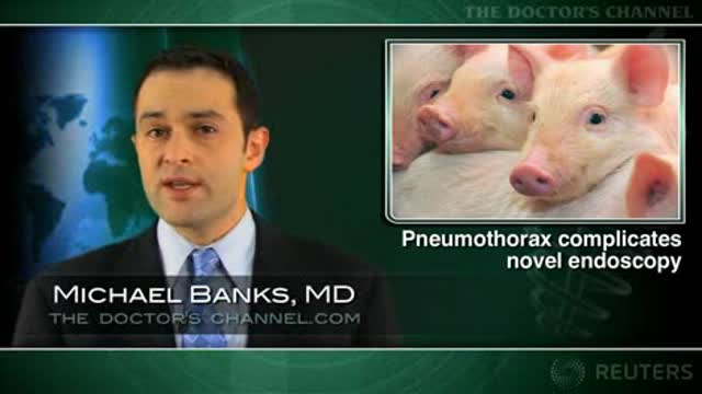 Substantial pneumothorax risk with transesophageal mediastinoscopy Thumbnail