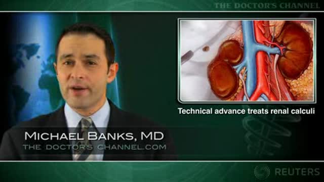Nephrolithotomy superior to lithotripsy for asymptomatic kidney stones Thumbnail