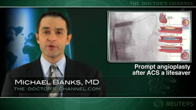 Angioplasty should be done within 24 hours of acute coronary syndrome onset Thumbnail