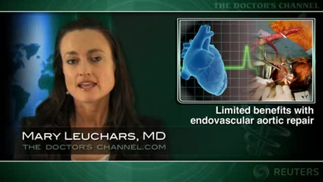 Endovascular versus open AAA repair: long-term outcomes fairly similar Thumbnail