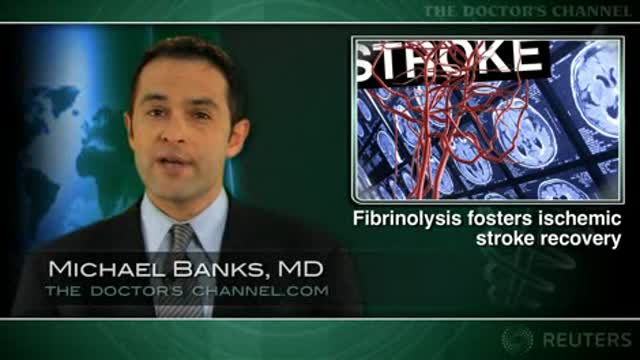 Intra-arterial fibrinolysis helpful after stroke Thumbnail