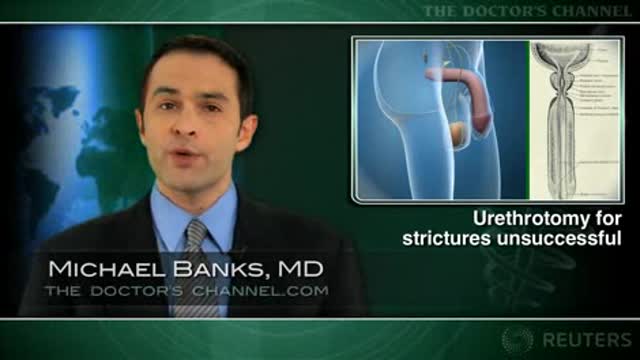 Urethrotomy success low and fleeting Thumbnail