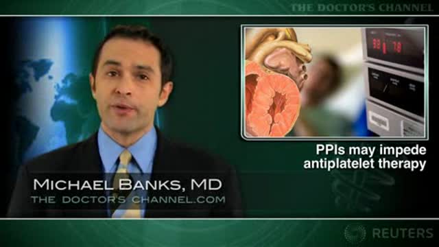 All PPI inhibitors, not just omeprazole, may interact with clopidogrel Thumbnail