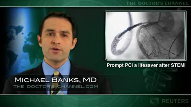 Post-MI reperfusion within 5 hours lengthens lives Thumbnail