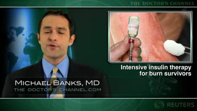 Tight euglycemic control has benefits in severely burned children Thumbnail