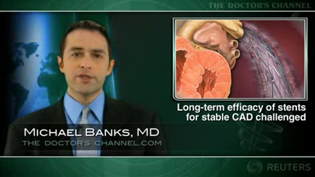 PCI shows no mortality benefit in stress positive CAD Thumbnail